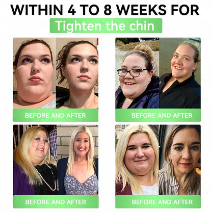 🧬Alcuras™ Moringa × Berberine × AMPK 8-Benefit Slimming & Metabolic Nano Microneedle Patch
